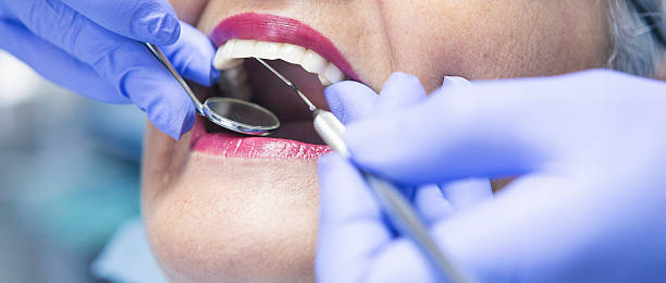 Best Emergency Wisdom Teeth Removal in Covington, VA